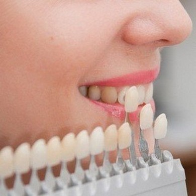 Протезирование зубов в Уральске