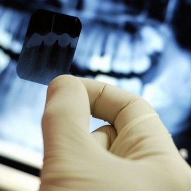 ЗD рентгенология